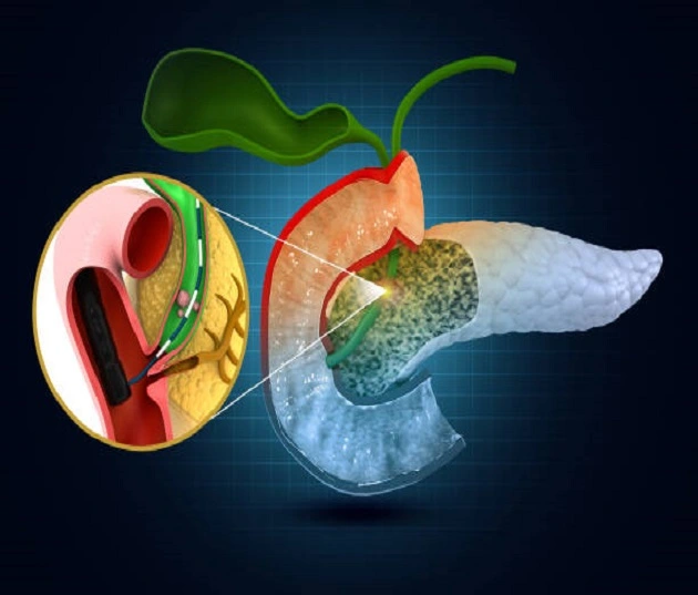 Best Pancreatic Surgeon in Vashi, Navi Mumbai